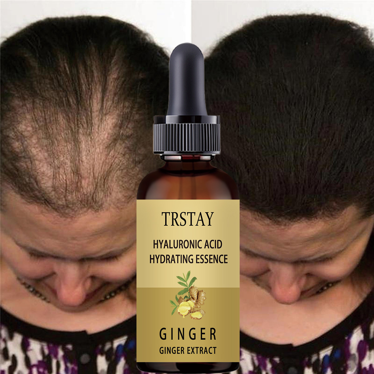 Hair Care Gisou - Hair Growth Serum Anti Preventing Hair