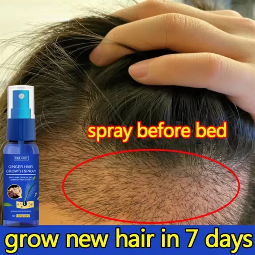 Hair Care Nutrition - Fast Ginger Hair Growth Spray Roots