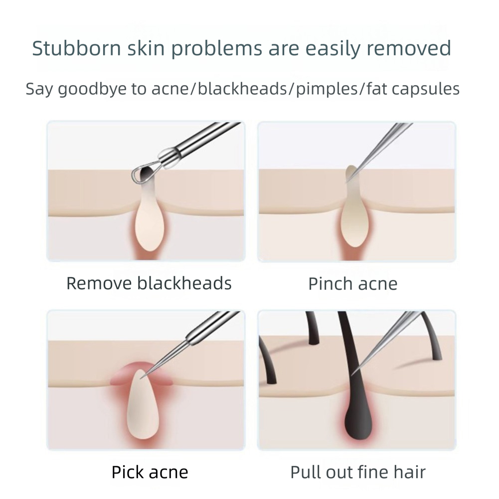 3-5pcs Ingrown Hair Tweezers A - Hair Care Clinic review and price