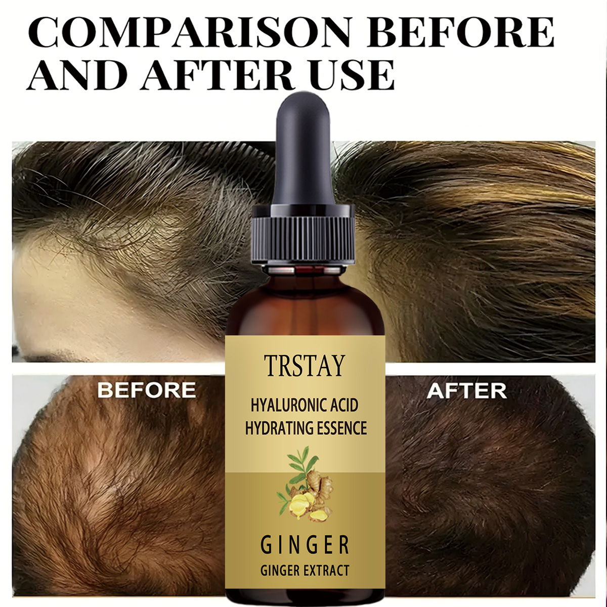 Hair Growth Serum Anti Prevent - Hair Care Gisou review and price