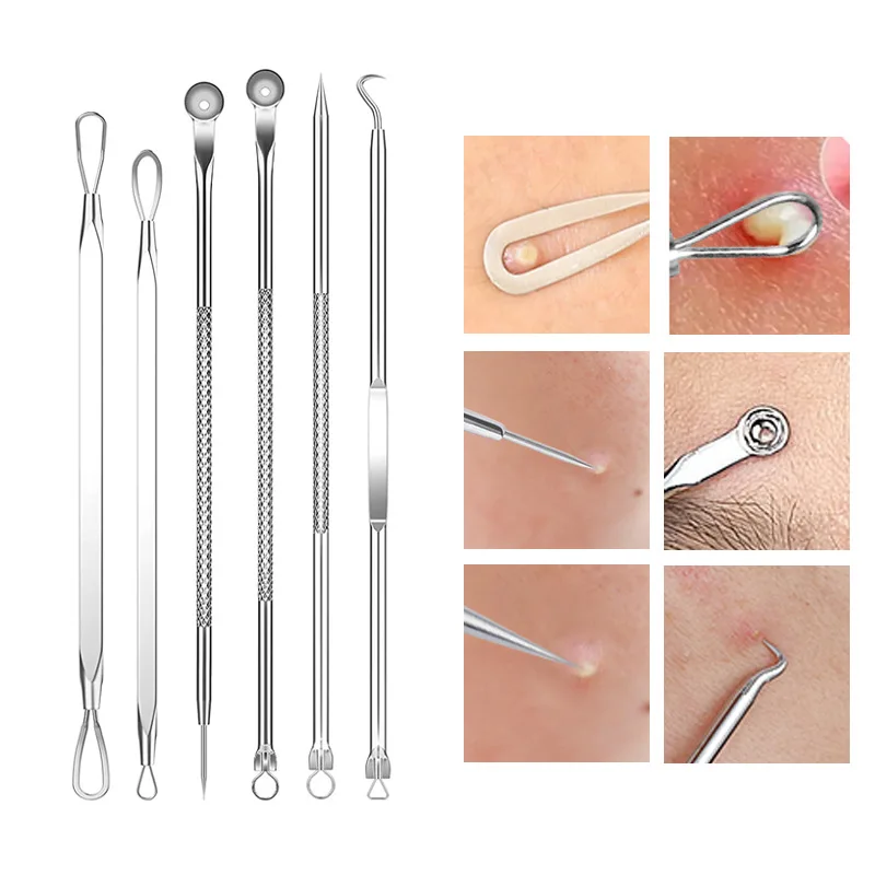 4-11Pcs Ingrown Hair Tweezers  - Hair Care Clinic review and price