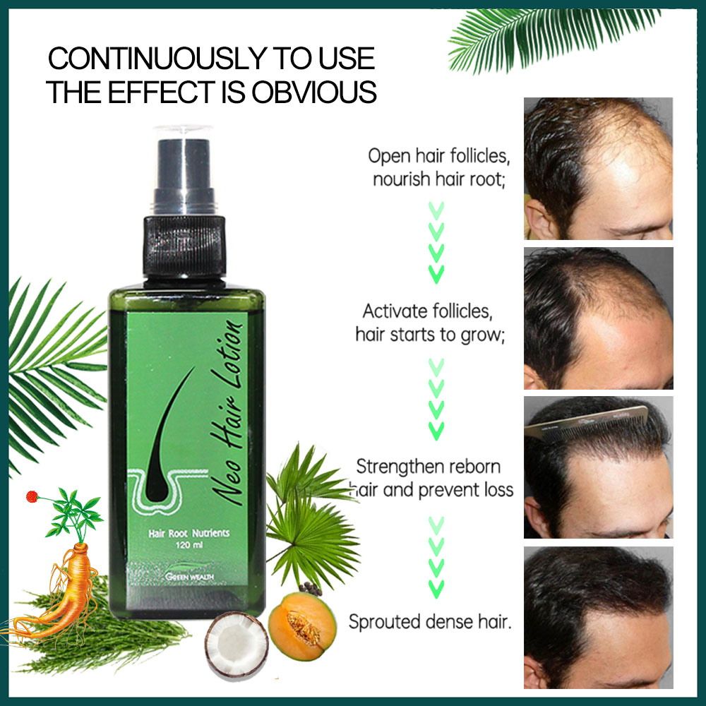 Original Neo Hair Lotion 120ml - Hair Care Gisou review and price